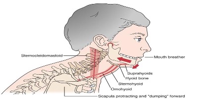Diagram of tongue root tension