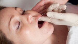 Intra-Oral Masseter Release